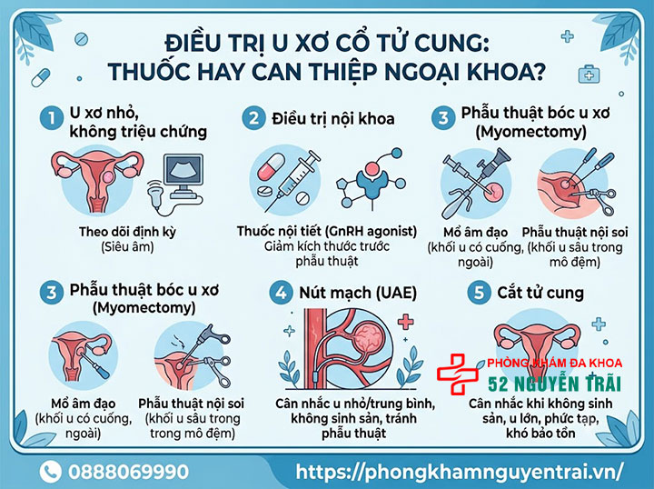 U Xơ Cổ Tử Cung Là Gì? Dấu Hiệu Và Cách Điều Trị 5 Điều trị u xơ cổ tử cung: thuốc hay can thiệp ngoại khoa?