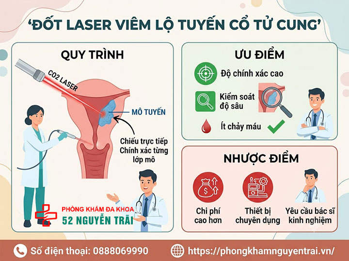 Đốt Viêm Lộ Tuyến Cổ Tử Cung: Phương Pháp, Chi Phí 3 Đốt laser viêm lộ tuyến cổ tử cung