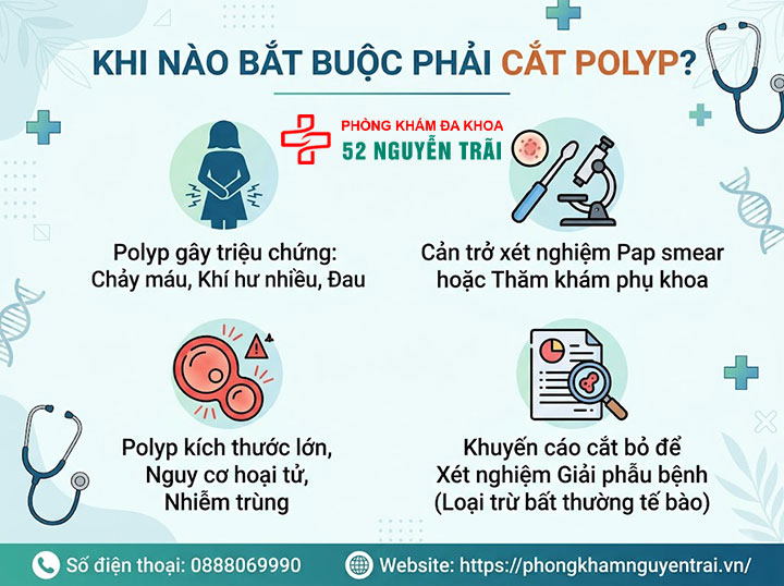 Polyp Cổ Tử Cung Có Nguy Hiểm Không? Có Nên Cắt? 4 Khi nào bắt buộc phải cắt polyp?