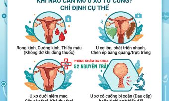 Khi nào cần mổ u xơ tử cung? Chỉ định cụ thể
