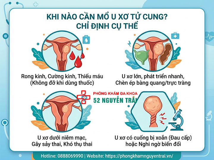 Mổ U Xơ Tử Cung: Các Phương Pháp Và Chi Phí 1 Khi nào cần mổ u xơ tử cung? Chỉ định cụ thể
