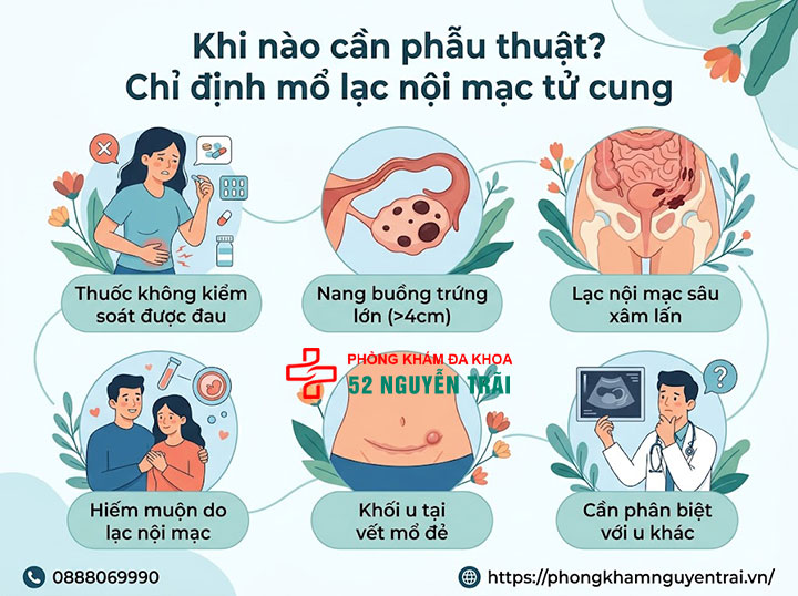 Mổ Lạc Nội Mạc Tử Cung: Khi Nào Cần, Chi Phí 1 Khi nào cần phẫu thuật? Chỉ định mổ lạc nội mạc tử cung