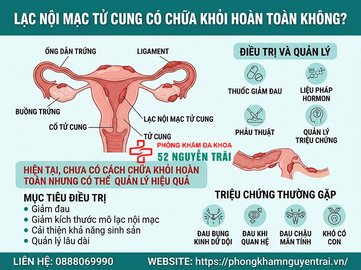 Điều Trị Lạc Nội Mạc Tử Cung: Thuốc Và Phác Đồ 6 Lạc nội mạc tử cung có chữa khỏi hoàn toàn không? Tiên lượng thực tế