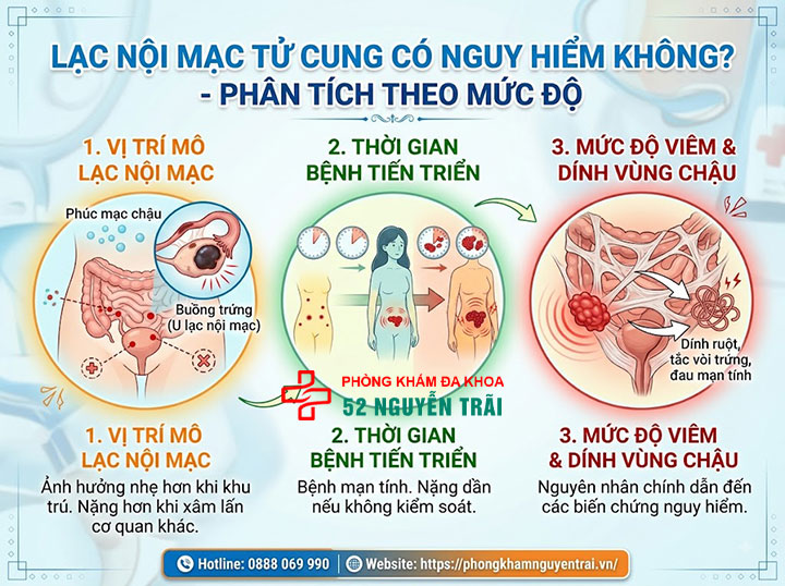 Lạc nội mạc tử cung có nguy hiểm không? Biến chứng cần biết 1 Lạc nội mạc tử cung có nguy hiểm không – phân tích theo mức độ