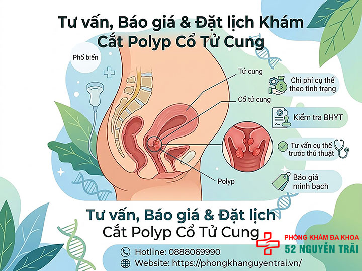 Chi Phí Cắt Polyp Cổ Tử Cung Hết Bao Nhiêu? 6 Liên hệ tư vấn báo giá và đặt lịch khám cắt polyp cổ tử cung