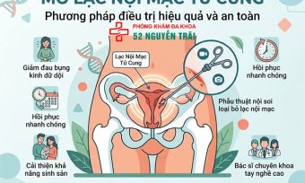 Mổ Lạc Nội Mạc Tử Cung: Khi Nào Cần, Chi Phí