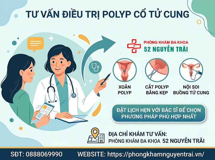 Cắt, Xoắn, Đốt Polyp Cổ Tử Cung: Phương Pháp, Quy Trình 7 Nên đặt lịch tư vấn để chọn phương pháp phù hợp chữa polyp cổ tử cung