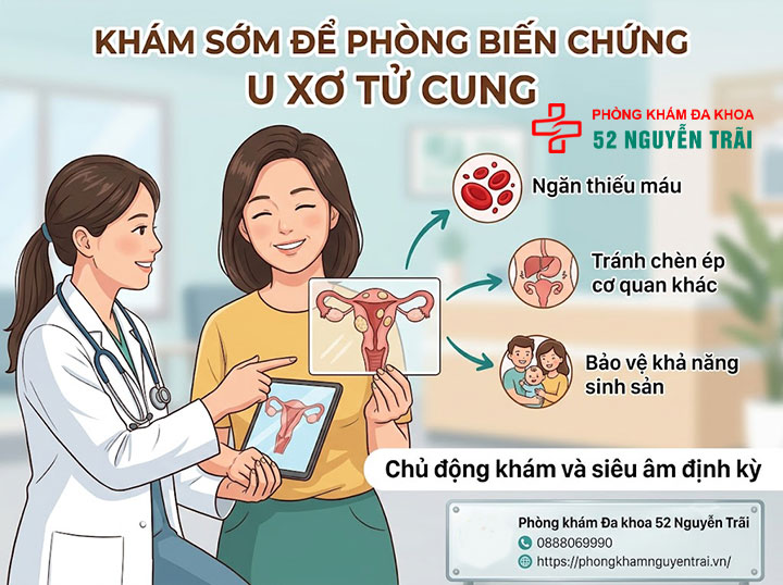 U Xơ Tử Cung Có Nguy Hiểm Không? Biến Chứng Cần Biết 8 Nên khám sớm để phòng biến chứng u xở tử cung nghiêm trọng