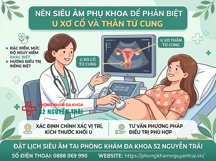 U Xơ Cổ Tử Cung Là Gì? Dấu Hiệu Và Cách Điều Trị 7 Nên siêu âm phụ khoa để phân biệt u xơ cổ và thân tử cung