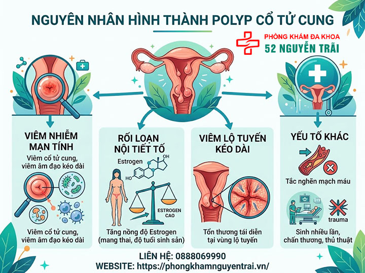 Nguyên Nhân, Triệu Chứng Và Hình Ảnh Polyp Cổ Tử Cung 1 Nguyên nhân hình thành polyp cổ tử cung