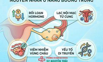 Nguyên nhân u nang buồng trứng và các yếu tố nguy cơ