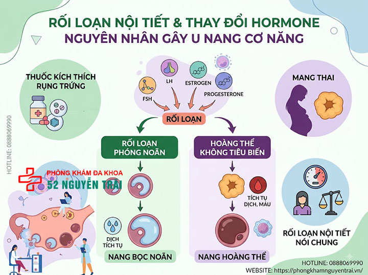 Nguyên nhân u nang buồng trứng và các yếu tố nguy cơ 2 Nguyên nhân u nang buồng trứng do Rối loạn nội tiết, thay đổi hormone