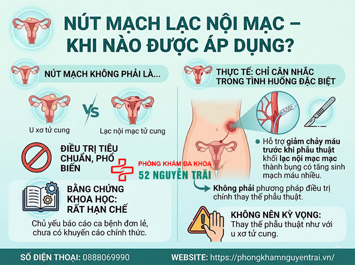 Mổ Lạc Nội Mạc Tử Cung: Khi Nào Cần, Chi Phí 5 Nút mạch lạc nội mạc – khi nào được áp dụng?