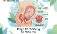Polyp Cổ Tử Cung Khi Mang Thai Có Nguy Hiểm Không?
