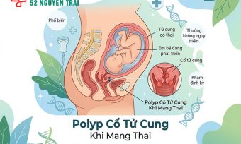 Polyp Cổ Tử Cung Khi Mang Thai