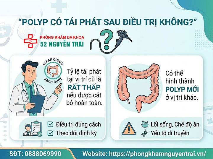 Cắt, Xoắn, Đốt Polyp Cổ Tử Cung: Phương Pháp, Quy Trình 6 Polyp có tái phát sau điều trị không?