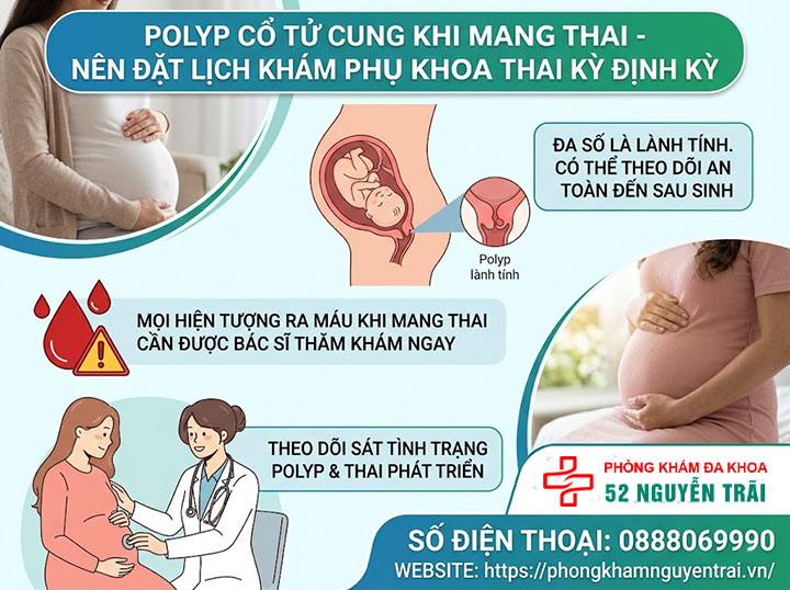 Polyp Cổ Tử Cung Khi Mang Thai Có Nguy Hiểm Không? 7 Polyp cổ tử cung khi mang thai Nên đặt lịch khám phụ khoa thai kỳ định kỳ