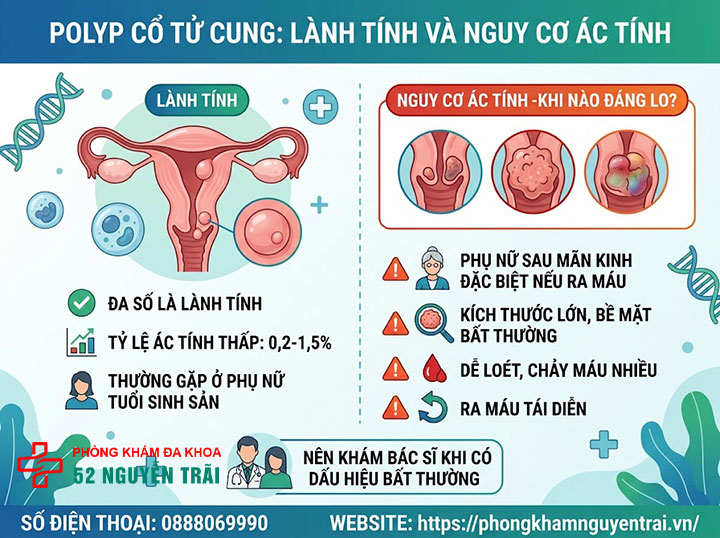 Polyp Cổ Tử Cung Có Nguy Hiểm Không? Có Nên Cắt? 2 Polyp lành tính và nguy cơ ác tính – khi nào đáng lo?