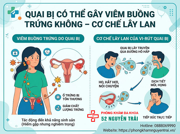 Viêm buồng trứng do quai bị: Triệu chứng và cách xử lý 1 Quai bị có thể gây viêm buồng trứng không cơ chế lây lan