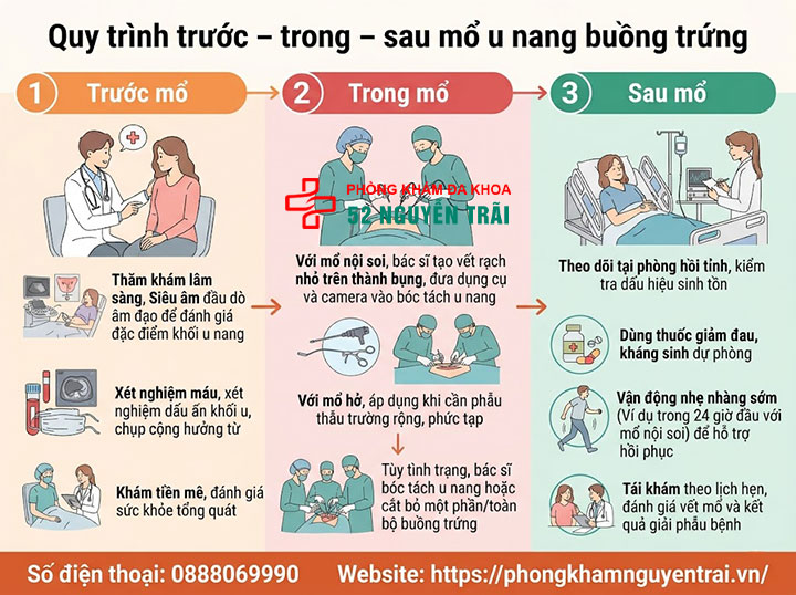 Mổ u nang buồng trứng: Khi nào cần, quy trình, chi phí 4 Quy trình trước – trong – sau mổ u nang buồng trứng