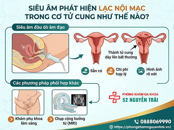 Lạc nội mạc trong cơ tử cung: Đặc điểm, triệu chứng và điều trị 4 Siêu âm phát hiện lạc nội mạc trong cơ tử cung như thế nào?