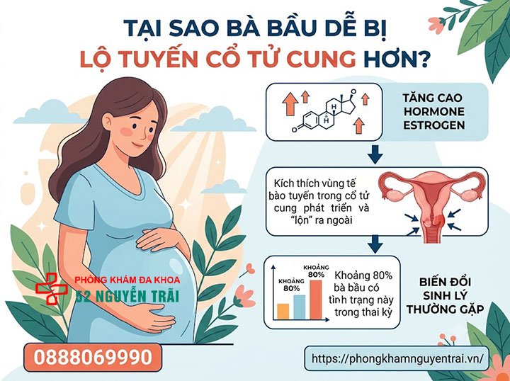 Viêm Lộ Tuyến Cổ Tử Cung Khi Mang Thai Có Sao Không? 1 Tại sao bà bầu dễ bị lộ tuyến cổ tử cung hơn?
