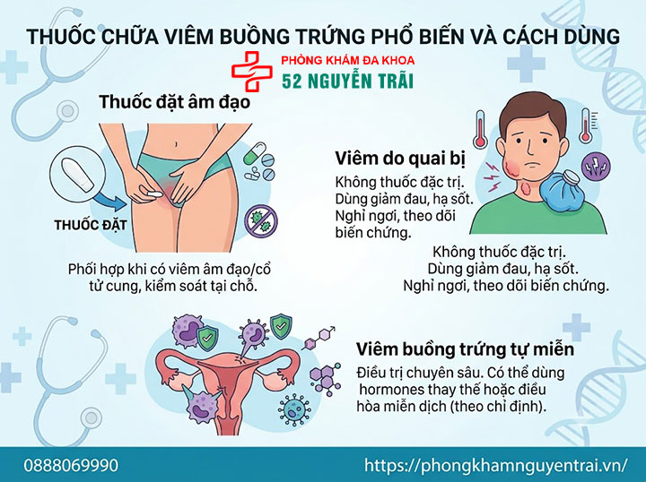 Điều Trị Viêm Buồng Trứng: Kháng Sinh Và Phác Đồ 3 Thuốc chữa viêm buồng trứng phổ biến và cách dùng