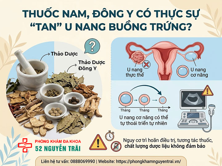 Điều trị u nang buồng trứng: Thuốc, đông y, dinh dưỡng 3 Thuốc nam, đông y, thảo dược – Có thực sự "tan" được u nang?