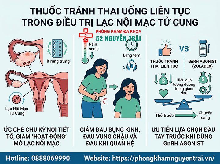 Điều Trị Lạc Nội Mạc Tử Cung: Thuốc Và Phác Đồ 4 Thuốc tránh thai uống liên tục vai trò trong điều trị lạc nội mạc tử cung
