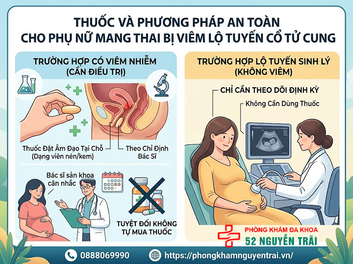 Viêm Lộ Tuyến Cổ Tử Cung Khi Mang Thai Có Sao Không? 4 Thuốc và phương pháp an toàn cho phụ nữ mang thai bị viêm lộ tuyến cổ tử cung