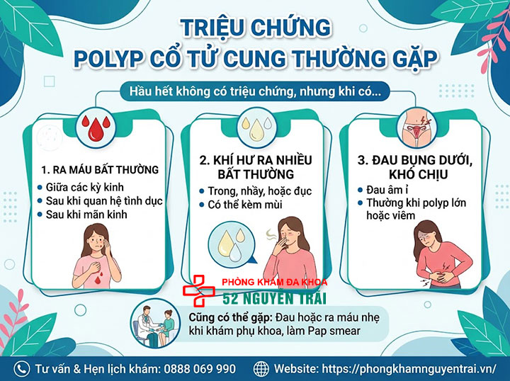 Nguyên Nhân, Triệu Chứng Và Hình Ảnh Polyp Cổ Tử Cung 2 Triệu chứng polyp cổ tử cung thường gặp: ra máu bất thường, khí hư, đau bụng