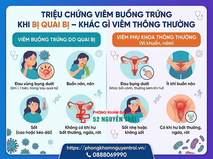 Viêm buồng trứng do quai bị: Triệu chứng và cách xử lý 2 Triệu chứng viêm buồng trứng khi bị quai bị – khác gì viêm thông thường