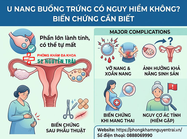 Dấu hiệu u nang buồng trứng và có nguy hiểm không? 4 U nang buồng trứng có nguy hiểm không? Biến chứng cần biết