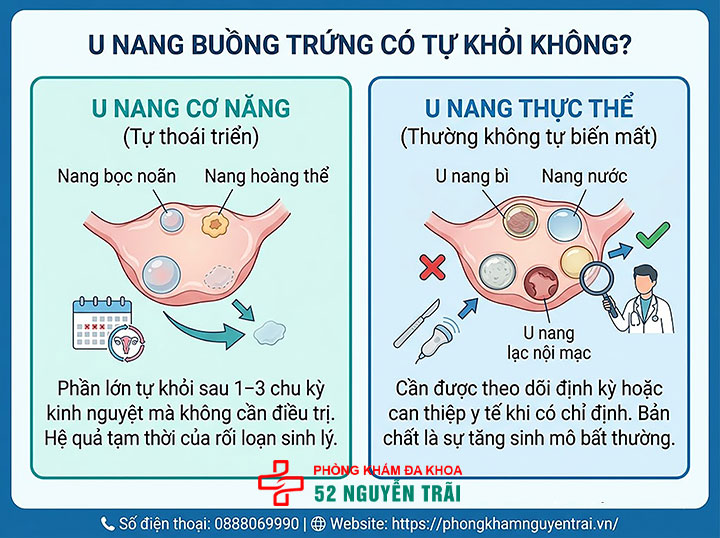 Dấu hiệu u nang buồng trứng và có nguy hiểm không? 8 U nang buồng trứng có tự khỏi không?