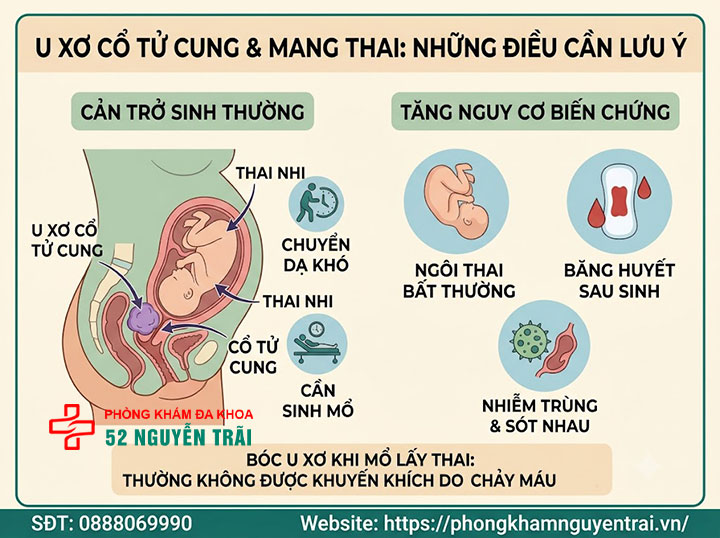 U Xơ Cổ Tử Cung Là Gì? Dấu Hiệu Và Cách Điều Trị 4 U xơ cổ tử cung có mang thai được không?