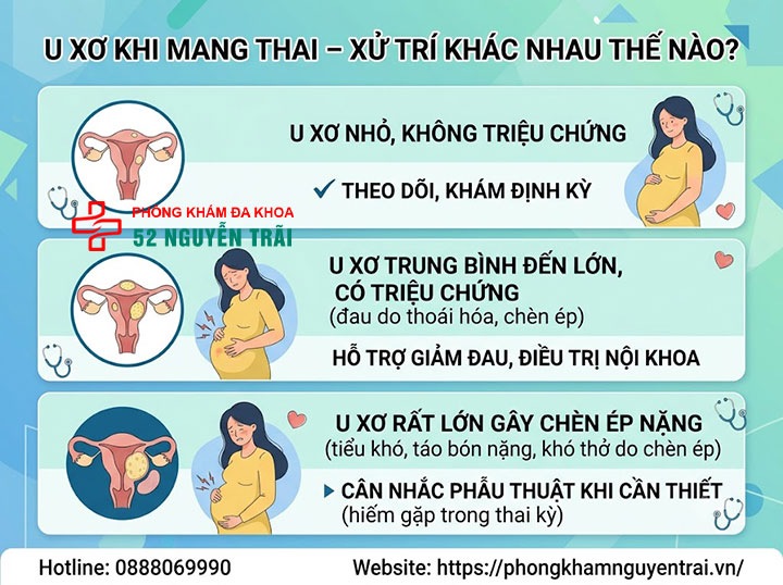 U Xơ Tử Cung Khi Mang Thai Có Nguy Hiểm Không? 4 U xơ nhỏ / u xơ to khi mang thai – xử trí khác nhau thế nào?