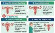 U Xơ Tử Cung Có Nguy Hiểm Không? Biến Chứng Cần Biết