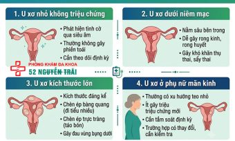 U xơ tử cung có nguy hiểm không? Phân tích theo kích thước và vị trí