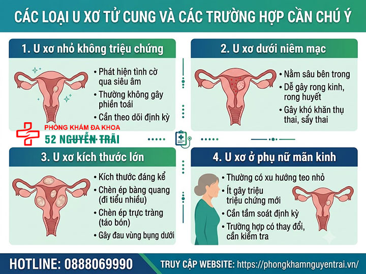 U Xơ Tử Cung Có Nguy Hiểm Không? Biến Chứng Cần Biết 1 U xơ tử cung có nguy hiểm không? Phân tích theo kích thước và vị trí