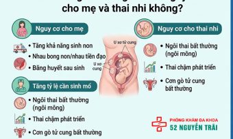 U Xơ Tử Cung Khi Mang Thai Có Nguy Hiểm Không?