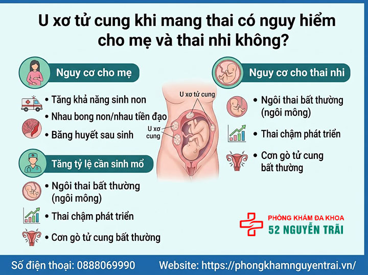 U Xơ Tử Cung Khi Mang Thai Có Nguy Hiểm Không? 1 U xơ tử cung khi mang thai có nguy hiểm cho mẹ và thai nhi không?