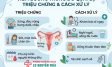 Viêm buồng trứng do quai bị: Triệu chứng và cách xử lý