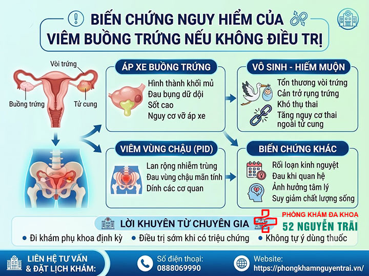 Viêm Buồng Trứng Có Nguy Hiểm Không? Giải Đáp Chi Tiết 2 Viêm buồng trứng nếu không điều trị: áp xe, vô sinh, viêm vùng chậu