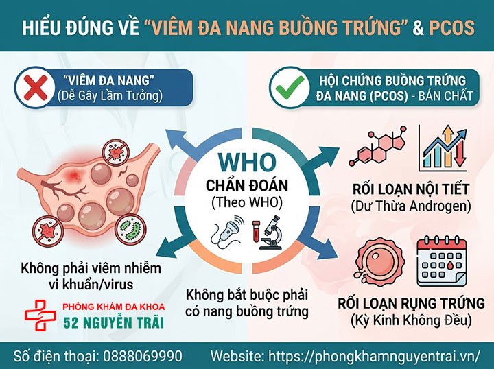 Viêm nang, viêm đa nang, viêm tai vòi buồng trứng: Phân biệt 2 Viêm đa nang buồng trứng – khác gì PCOS thông thường