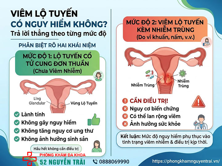 Viêm Lộ Tuyến Cổ Tử Cung Có Nguy Hiểm Không? 1 Viêm lộ tuyến có nguy hiểm không? Trả lời thẳng theo từng mức độ