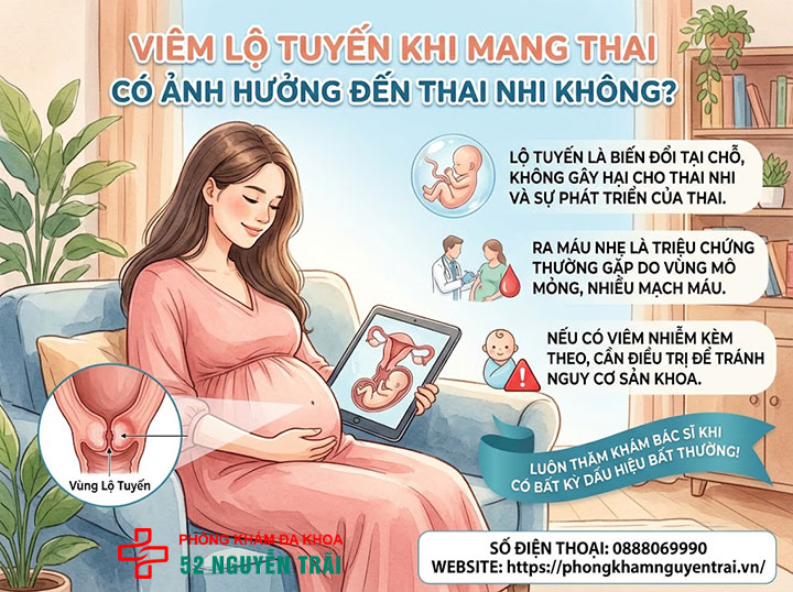 Viêm Lộ Tuyến Cổ Tử Cung Khi Mang Thai Có Sao Không? 2 Viêm lộ tuyến khi mang thai có ảnh hưởng đến thai nhi không?
