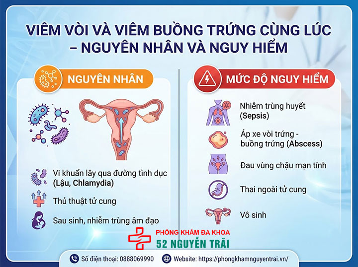 Viêm nang, viêm đa nang, viêm tai vòi buồng trứng: Phân biệt 4 Viêm vòi và viêm buồng trứng cùng lúc – nguyên nhân và nguy hiểm
