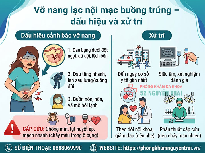 Lạc nội mạc tử cung có nguy hiểm không? Biến chứng cần biết 5 Vỡ nang lạc nội mạc buồng trứng – dấu hiệu và xử trí
