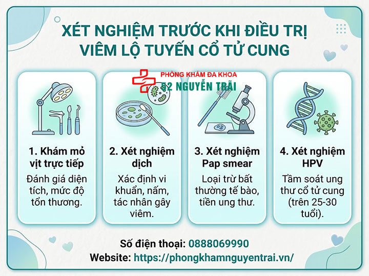 Điều Trị Viêm Lộ Tuyến Cổ Tử Cung: Thuốc Và Phác Đồ 7 Xét nghiệm nào cần làm trước khi điều trị viêm lộ tuyến cổ tử cung?