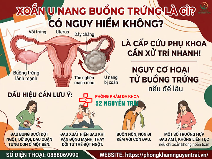 Dấu hiệu u nang buồng trứng và có nguy hiểm không? 6 Xoắn u nang buồng trứng là gì? Có nguy hiểm không?